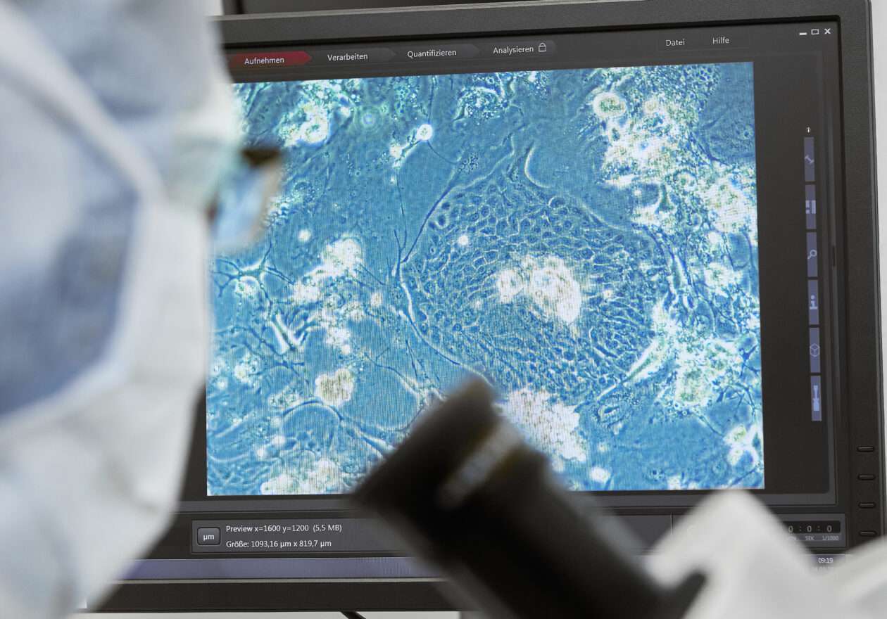 Mikroskopische Darstellung von Zellkulturen auf einem Monitor im Labor
