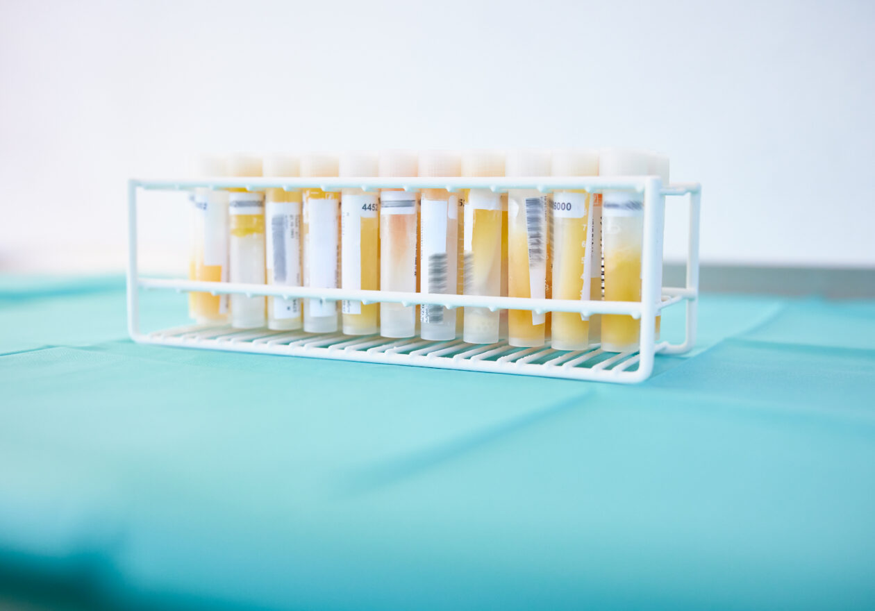 7. Labeling of plasma samples
